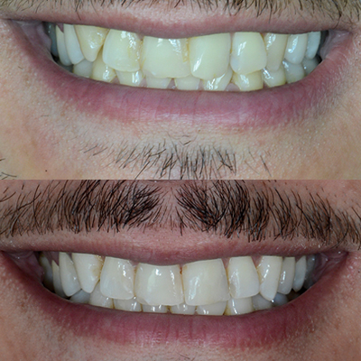 Dentiste Oberhausbergen